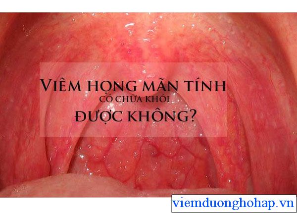 Viêm họng hạt mãn tính có chữa được không?