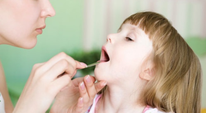 Bệnh viêm họng cấp ở trẻ em