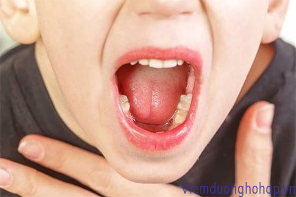 Thế nào là viêm amidan lưỡi? 1