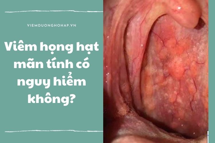 Mắc viêm họng hạt mãn tính có nguy hiểm không?