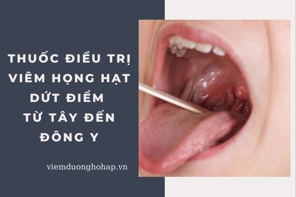 Thuốc điều trị viêm họng hạt dứt điểm từ Tây đến Đông y