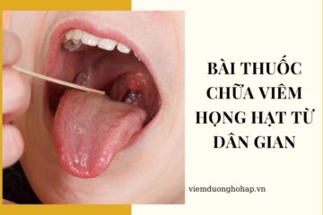 Bài thuốc chữa viêm họng hạt từ dân gian