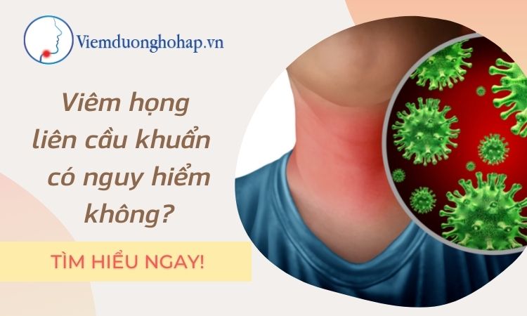 Viêm họng liên cầu khuẩn - hiểu rõ trong vài phút!