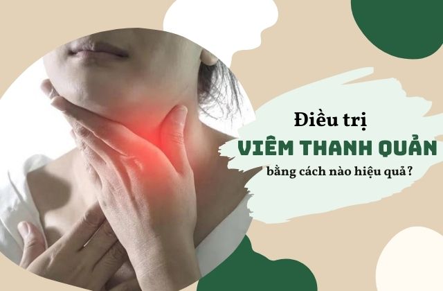 Điều trị viêm thanh quản bằng cách nào hiệu quả?