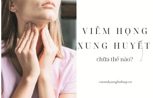 Viêm họng xung huyết - chữa cách nào?