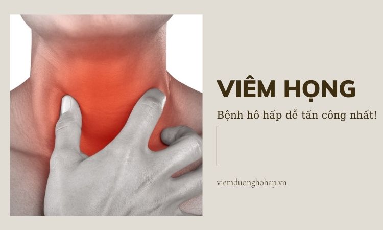 Viêm họng là gì? - Bệnh hô hấp dễ tấn công nhất!