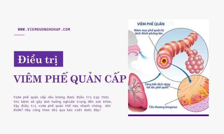 Điều trị viêm phế quản cấp thế nào cho hiệu quả?